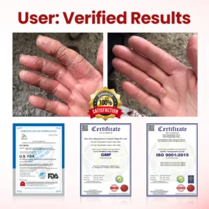 🔥Extra 40% Off 2nd Item!✨️Healrize® FootGuard Diabetic Care Cream