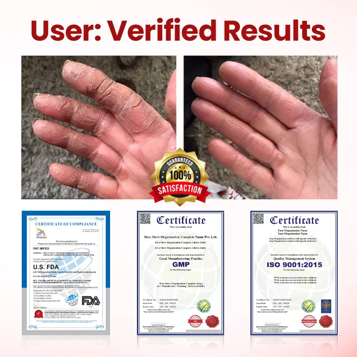 🔥Extra 40% Off 2nd Item!✨️Healrize® FootGuard Diabetic Care Cream