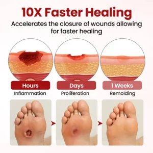 🔥Extra 40% Off 2nd Item!✨️Healrize® FootGuard Diabetic Care Cream