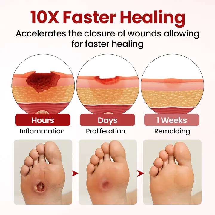 🔥Extra 40% Off 2nd Item!✨️Healrize® FootGuard Diabetic Care Cream