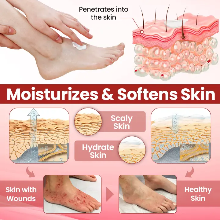 🔥Extra 40% Off 2nd Item!✨️Healrize® FootGuard Diabetic Care Cream