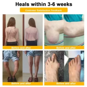 Healrize® BEE VENOM LITHOSPERMUM Pain-Relief Bone Healing Cream