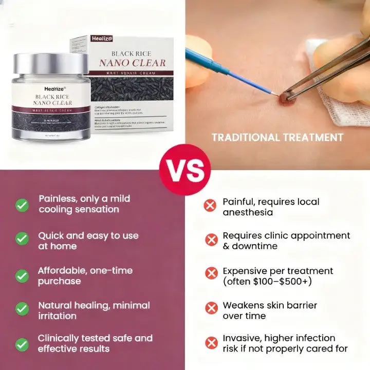 Healrize® BlackRice Nano Clear Wart Repair Cream