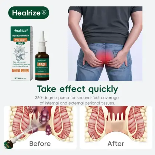 Healrize® Fast Hemorrhoid PRO Spray