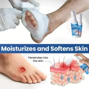 Healrize® GlucoShield Dermal Spray