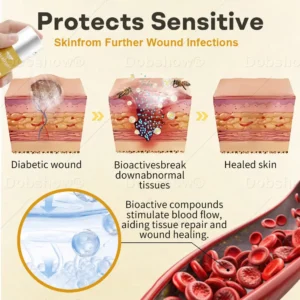 🔥 𝙅𝙖𝙣𝙪𝙖𝙧𝙮 𝙁𝙡𝙖𝙨𝙝 𝙎𝙖𝙡𝙚 | Healrize® GlucoShield Bee Venom Wound Spray