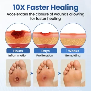 ⏰ EXCLUSIVE DEAL 60% OFF + FREE SHIPPING🔥 Healrize® GlucoSkin Protect Spray