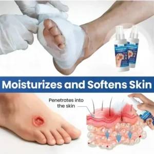 HEALRIZE® DIABEDERM BIO-DEFENSE SPRAY