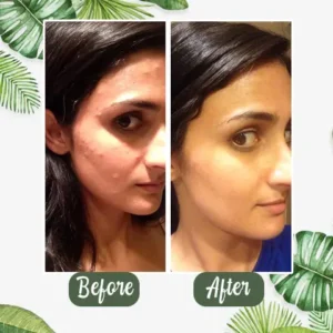 Healrize™  100% Natural Green Tea Deep Cleanse Mask