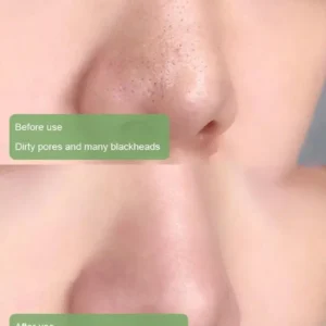 Healrize™  100% Natural Green Tea Deep Cleanse Mask