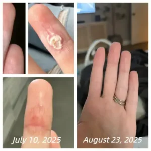 Healrize® Bee Venom Spray Joint Relief Wart Treatment, Two Effects in One Bottle