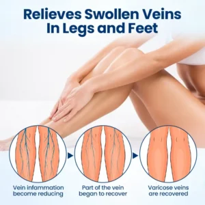 Healrize® Micro-Mist
        Herbal Varicose Veins Spray