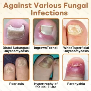 Healrize® NailRescue BeeVenom Renewal Spray