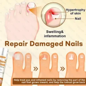 Healrize® NailRescue BeeVenom Renewal Spray