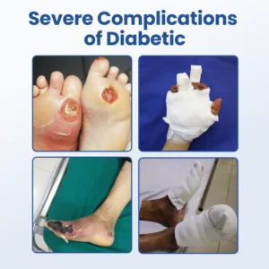 ⏰Last Day Promotion: 60% OFF🔥 HEALRIZE® DIABEDERM BIO-DEFENSE SPRAY