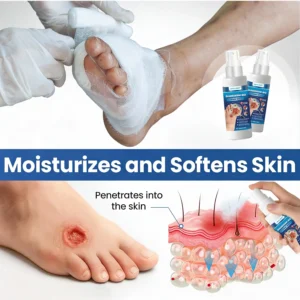 ⏰Last Day Promotion: 60% OFF🔥 HEALRIZE® DIABEDERM BIO-DEFENSE SPRAY