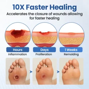 ⏰Last Day Promotion: 60% OFF🔥 HEALRIZE® DIABEDERM BIO-DEFENSE SPRAY