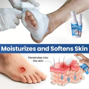 ⏰Last Day Promotion: 60% OFF🔥Healrize® GlucoShield Dermal Spray 🔥