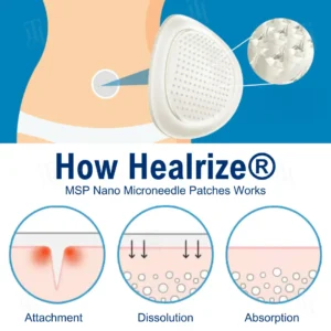 Transform Your Body in 7 Days with Healrize® Nano Microneedle Patches