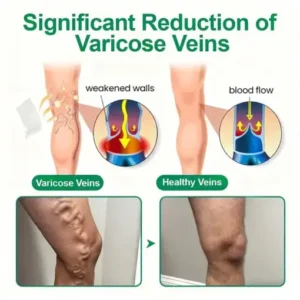 Healrize® VeinTarget Microneedle Patch Once Daily, Visible Results in 7 Days