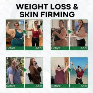 Healrize®7-Day Herbal Nanoneedle Shaping Patch™ Addressing Obesity, Diabetes, High blood pressure, and Sleep apnea Issues