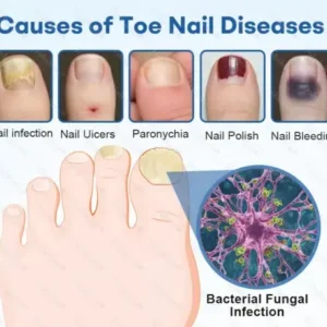 Healrize®Nano Rapid Clear Nail Fungus Rapair Liquid Effective in Seven Days, Permanently Eliminates the Root