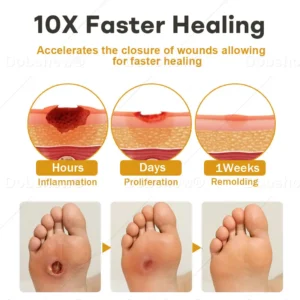 🔥 𝙇𝙞𝙢𝙞𝙩𝙚𝙙 𝙊𝙛𝙛𝙚𝙧 – 𝙎𝙖𝙫𝙚 𝙏𝙤𝙙𝙖𝙮 | Healrize® GlucoShield Bee Venom Wound Spray🔥#1 Best-Selling Wound Care Spray