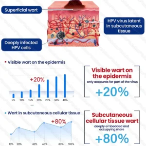 🔥𝙈𝙖𝙧𝙘𝙝 𝙎𝙥𝙚𝙘𝙞𝙖𝙡 𝙊𝙛𝙛𝙚𝙧𝙨 | Healrize® WartLock Cryo-Recovery Cooling Spray