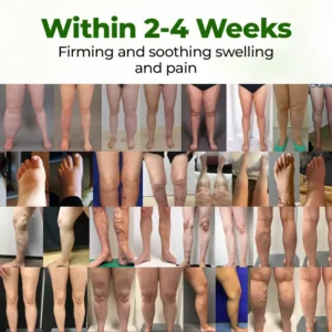 🇺🇸 Official USA Store • Trusted Nationwide
        
        
        
            Healrize® Advanced Leg Circulation Cream
        

        
            Fast relief for heavy, swollen & tired legs — no compression needed