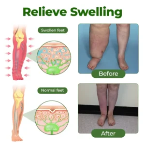 🇺🇸 Official USA Store • Trusted Nationwide
        
        
        
            Healrize® Advanced Leg Circulation Cream
        

        
            Fast relief for heavy, swollen & tired legs — no compression needed