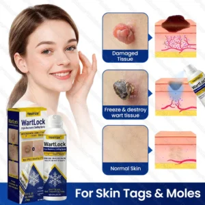 🔥Best Seller🔥Healrize® WartLock Cryo-Recovery Cooling Spray🎉Special limited-time discount