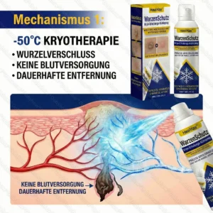 🔥Bestseller🔥Healrize® WartLock Kryo-Recovery Kühlspray🎉 Zeitlich begrenzter Sonderrabatt