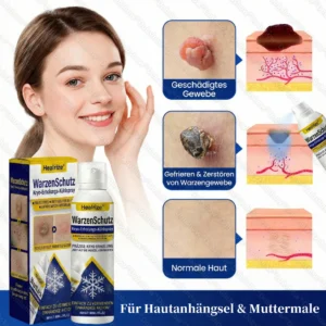 🔥Bestseller🔥Healrize® WartLock Kryo-Recovery Kühlspray🎉 Zeitlich begrenzter Sonderrabatt