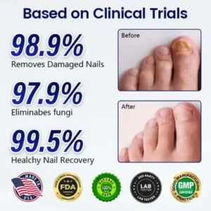 Healrize® Anti-Fungal Nail Repair Patch