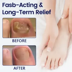 Healrize® Anti-Fungal Nail Repair Patch