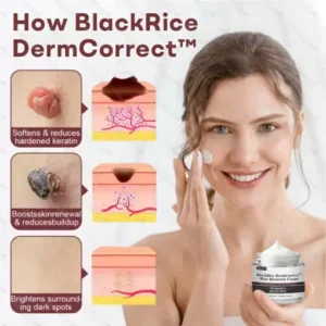 Healrize® BlackRice DermCorrect™ Wart Recovery Cream Suitable for all skin types