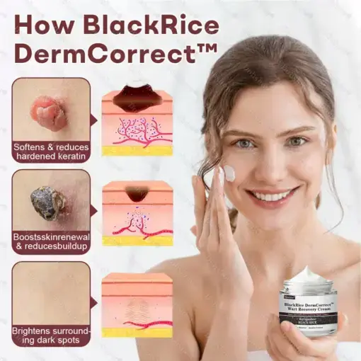 Healrize® BlackRice DermCorrect™ Wart Recovery Cream Suitable for all skin types
