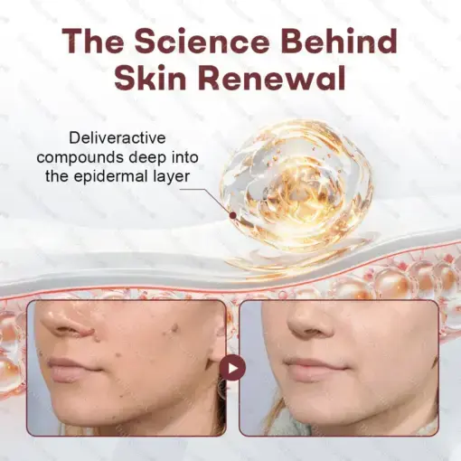 Healrize® BlackRice DermCorrect™ Wart Recovery Cream Suitable for all skin types