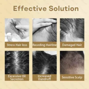 Healrize® Hair Regrowth Capsules Newly Upgraded,Nano Penetration, Deep into Hair Roots