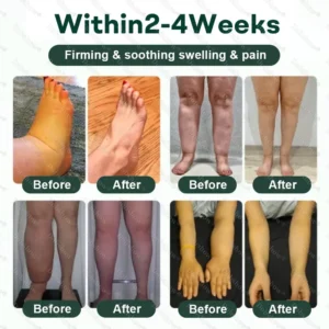 Healrize® LymphDrain Herbal Soothing Cream