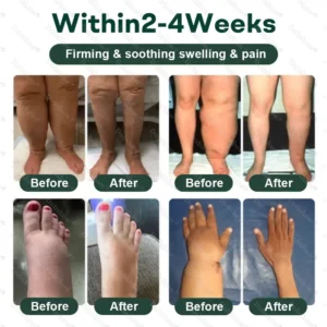 Healrize® LymphDrain Herbal Soothing Cream