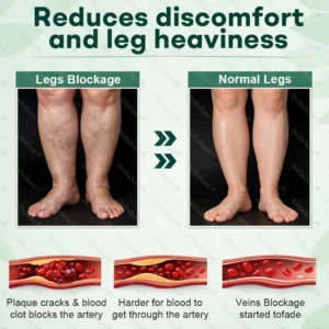 Healrize® LymphDrain Herbal Soothing Cream