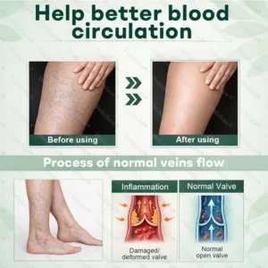 Healrize® LymphDrain Herbal Soothing Cream