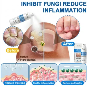 🔥Healrize® Magnesium Botanical Spray – Advanced Skin Recovery for Psoriasis & Eczema | Rapid Soothing, Steroid-Free