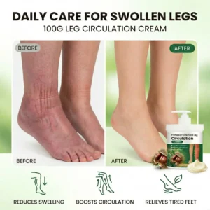 Healrize®🍃 Professional Natural Leg Circulation Cream——Targeted Relief for Swelling, Puffiness & Heavy Legs