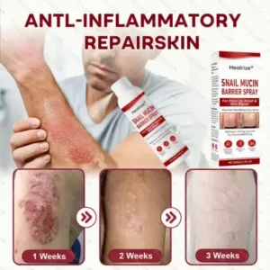 Healrize® Snail Mucin Barrier Spray for Flare-Up Relief & Skin Repair