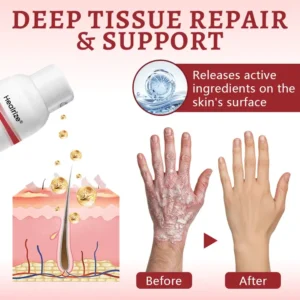 Healrize® Snail Mucin Healing Spray – Relief for Sensitive & Flare-Up Skin