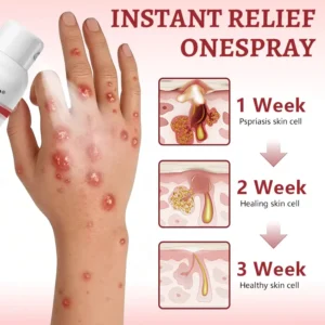 Healrize® Snail Mucin Healing Spray – Relief for Sensitive & Flare-Up Skin