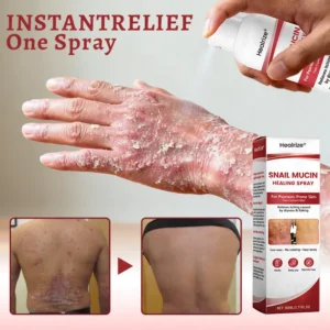 Healrize® Snail Mucin Healing Spray – Relief for Sensitive & Flare-Up Skin