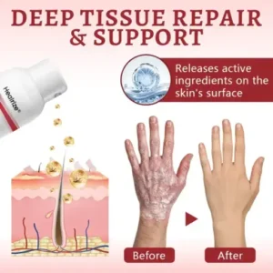 Healrize® Snail Mucin Healing Spray